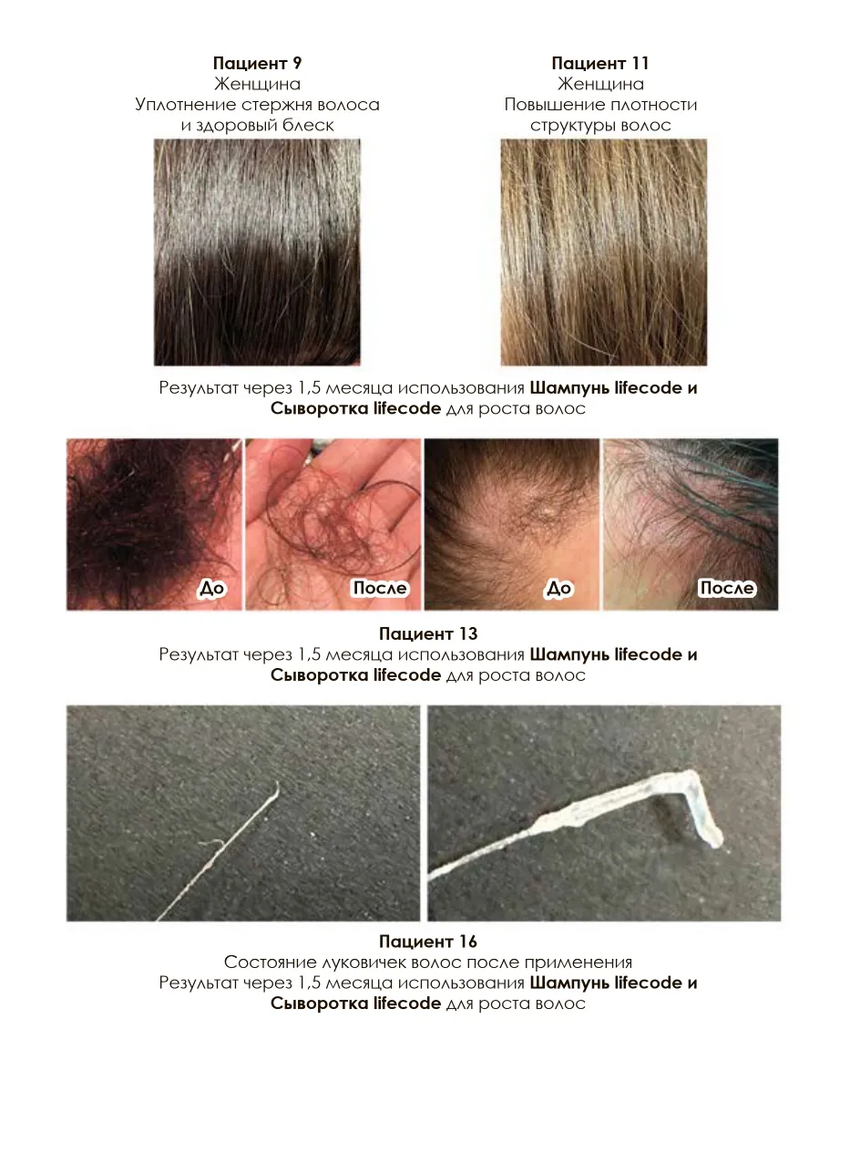 Сыворотка активатор роста волос